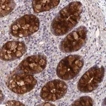 Merck Anti-CCDC66 antibody produced in rabbit