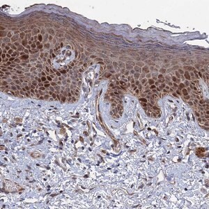 Merck Anti-GTF2IRD1 antibody produced in rabbit