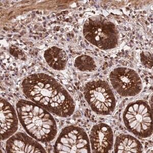 Merck Anti-GPATCH8 antibody produced in rabbit