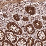 Merck Anti-GPATCH8 antibody produced in rabbit