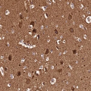 Merck Anti-ADAMTS18 antibody produced in rabbit