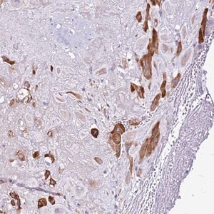 Merck Anti-CASD1 antibody produced in rabbit