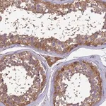 Merck Anti-GID4 antibody produced in rabbit