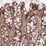 Merck Anti-ABHD1 antibody produced in rabbit