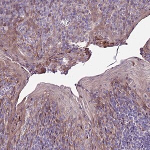 Merck Anti-NOL8 antibody produced in rabbit