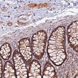 Merck Anti-TIGD6 antibody produced in rabbit
