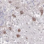 Merck Anti-PITX3 antibody produced in rabbit