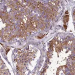 Merck Anti-SLC26A10 antibody produced in rabbit