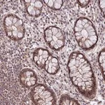 Merck Anti-ZNF85 antibody produced in rabbit