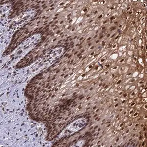 Merck Anti-TADA3 antibody produced in rabbit