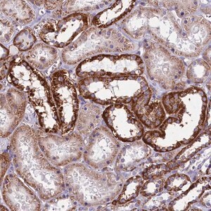 Merck Anti-IL20RA antibody produced in rabbit