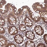 Merck Anti-ELOVL6 antibody produced in rabbit