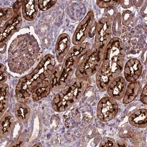 Merck Anti-ARSK antibody produced in rabbit