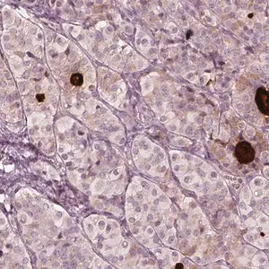 Merck Anti-MIA antibody produced in rabbit
