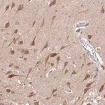 Merck Anti-BSCL2 antibody produced in rabbit
