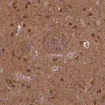 Merck Anti-TNK2 antibody produced in rabbit