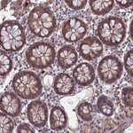 Merck Anti-LYPD5 antibody produced in rabbit