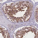 Merck Anti-DCAF16 antibody produced in rabbit