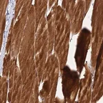 Merck Anti-PIKFYVE antibody produced in rabbit
