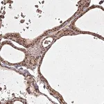 Merck Anti-ING5 antibody produced in rabbit