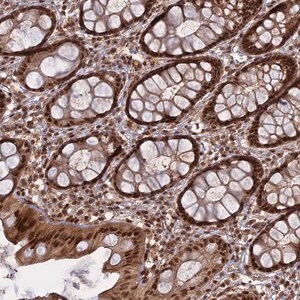 Merck Anti-PKIG antibody produced in rabbit