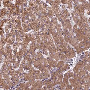 Merck Anti-FADS1 antibody produced in rabbit