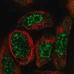 Merck Anti-WDR17 antibody produced in rabbit