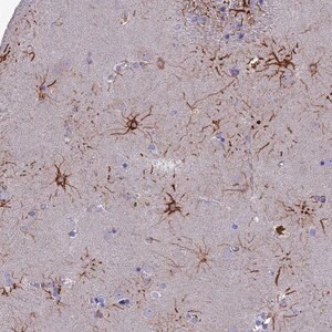 Merck Anti-CYB561D2 antibody produced in rabbit