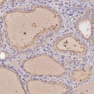 Merck Anti-SLC26A4 antibody produced in rabbit