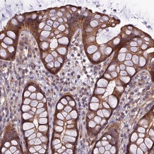Merck Anti-ADAMTS15 antibody produced in rabbit