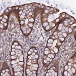 Merck Anti-ADAMTS15 antibody produced in rabbit