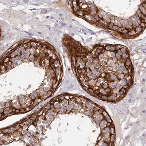 Merck Anti-DEFB119 antibody produced in rabbit