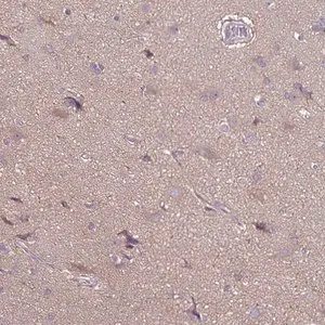 Merck Anti-FSD1 antibody produced in rabbit