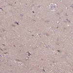 Merck Anti-FSD1 antibody produced in rabbit