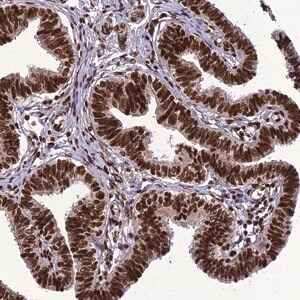 Merck Anti-INO80E antibody produced in rabbit