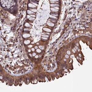 Merck Anti-DAPK3 antibody produced in rabbit