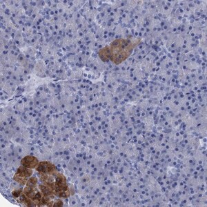 Merck Anti-FOXR2 antibody produced in rabbit