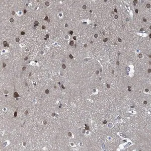 Merck Anti-CCDC34 antibody produced in rabbit