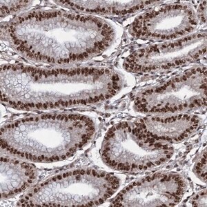 Merck Anti-PRPF18 antibody produced in rabbit