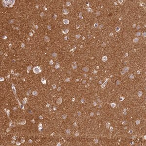 Merck Anti-MADD antibody produced in rabbit