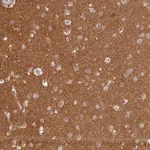 Merck Anti-MADD antibody produced in rabbit