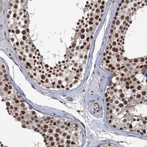 Merck Anti-RASSF4 antibody produced in rabbit