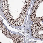 Merck Anti-RASSF4 antibody produced in rabbit
