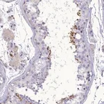 Merck Anti-FAM149B1 antibody produced in rabbit