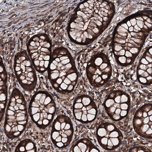 Merck Anti-KIF18A antibody produced in rabbit