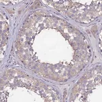 Merck Anti-USPL1 antibody produced in rabbit