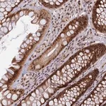 Merck Anti-CKAP2L antibody produced in rabbit