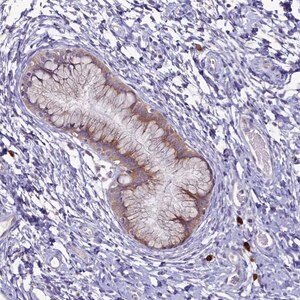 Merck Anti-METTL25 antibody produced in rabbit