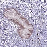 Merck Anti-METTL25 antibody produced in rabbit