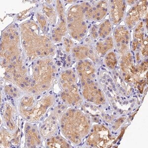 Merck Anti-DGKH antibody produced in rabbit